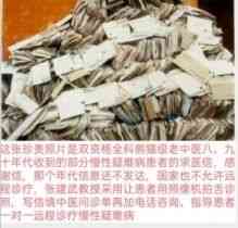 观两会论健康 特别报道当代民间调理大师——张建武