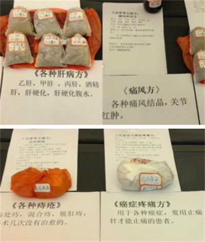 【聚焦两会报道】 著名贵州名医---王家贵