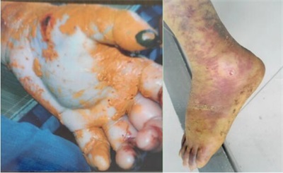 弘扬劳模精神 争当时代先锋 访黄山市徽州毒蛇研究所所长---汪炳炎