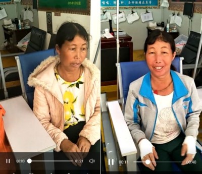 痔疮鼻炎无效退款，广西百色杨忠雅医师