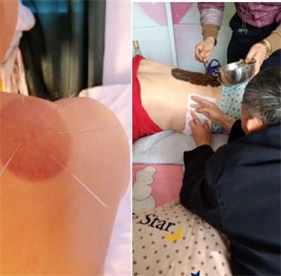 韩秀能：传承中医薪火，耕耘健康沃土