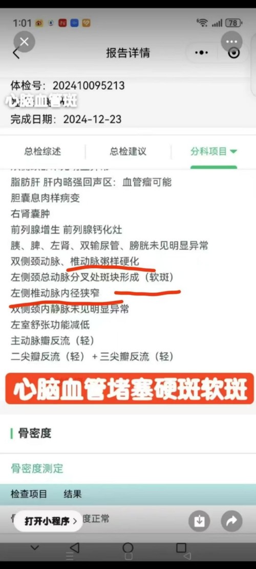 论中风偏瘫三高的调理与康复 作者刘建清字号梅山医痴！