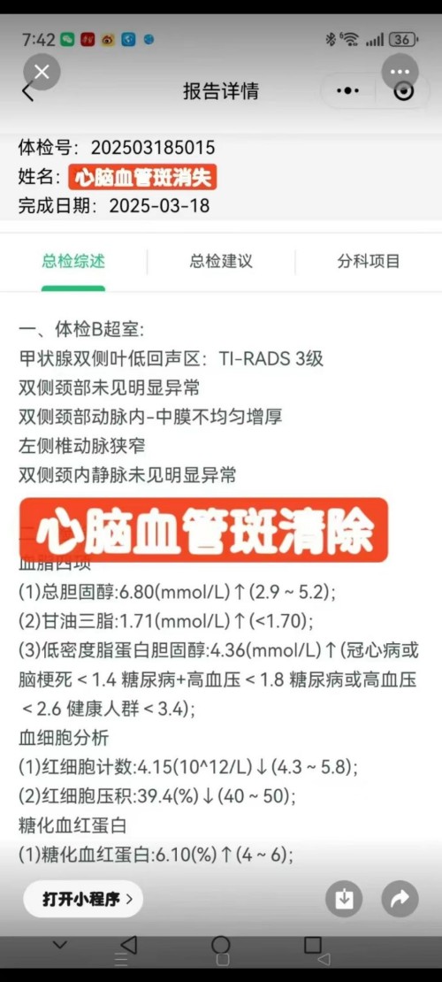 论中风偏瘫三高的调理与康复 作者刘建清字号梅山医痴！