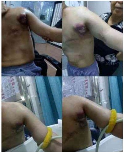 敬佑生命 守护健康 甘于奉献 大爱无疆 ---------仁心医者钱碑清