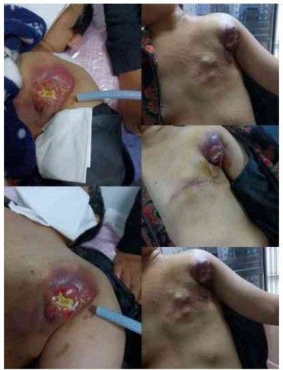 敬佑生命 守护健康 甘于奉献 大爱无疆 ---------仁心医者钱碑清