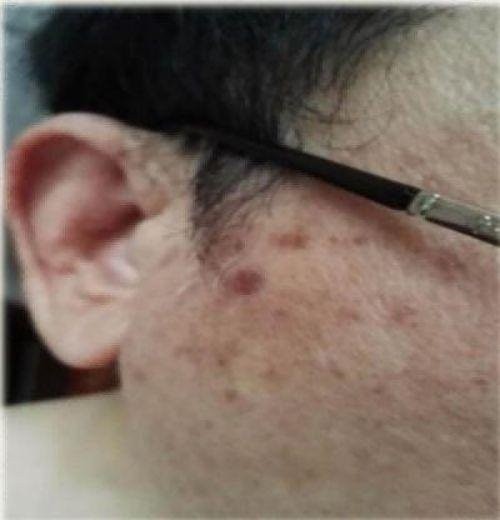 2026献礼两会特别报道 量子氢氧健康第一人长寿哥(廖永贵)