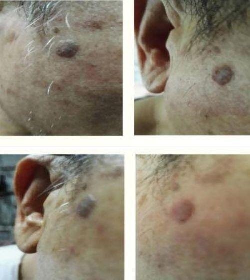 践行“十五五”健康中国战略： 量子氢氧健康第一人廖永贵——用科技点亮生命健康之光