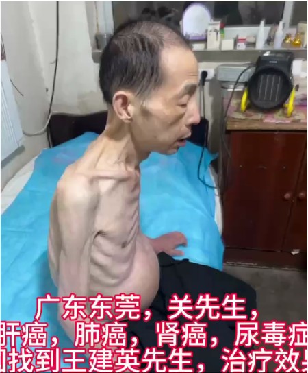 八一专题报道 新时代国医名师---王建英