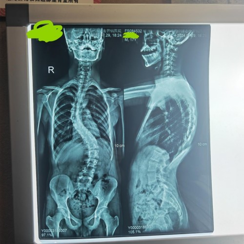 宫廷整脊正骨：王洪喜与通脉整骨堂的百年非遗传承之路