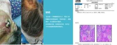 访新时代大健康科研人才 兰溪永球医院院长---宁永球