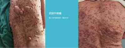 大国医者 国医名师——宁永球