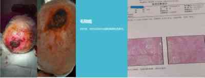 大国医者 国医名师——宁永球